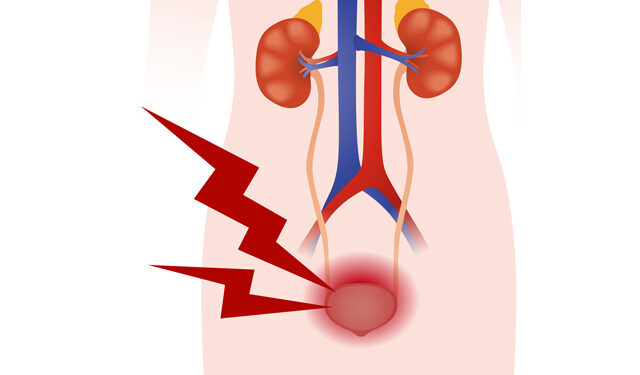 억지로 소변 참으면 신장에 돌 생긴다?