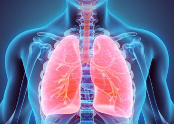 비흡연자도 안심 금물…비흡연 여성 폐암 발병률 증가