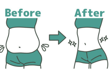 환자에게 알려줄 ‘체중감량 후 요요현상 막는 노하우’