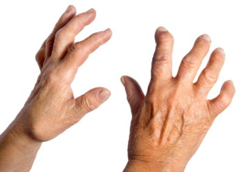 이따금씩 찾아오는 ‘손발저림’ 원인은?