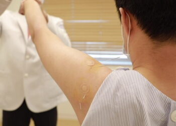 오십견 등 어깨통증에 한방치료 효과 확인