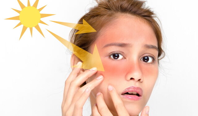 (양방) 한여름, 자외선 노출 잦다면?