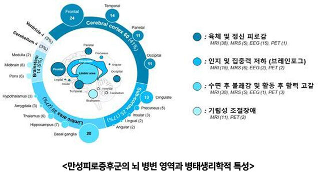 만성피로증후군 환자, 뇌 영역별 특성·뇌 염증 병태 규명