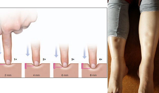 조현창 원장의 TEM (35) 방기복령탕, 30~40대 이상 기력 약하고 늘 피로한 중노년자 빈용방