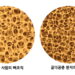 골다공증, 효과적으로 예방하는 방법은?