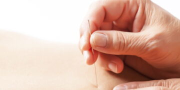 조병식 원장의 최신 동씨침 ⑬ 삼중, 사화외 방혈, 모든 귀질환의 통치방