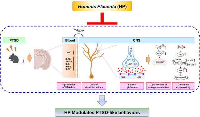 PTSD, 태반 추출물 ‘자하거’ 약침으로 치료