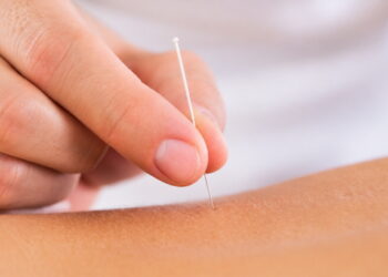 오세준 원장의 침 치료 원리 ① 경락의 기운을 끌어당기고 밀어주는 ‘자침 원리’