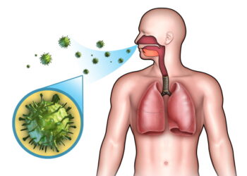 아토피·비염·천식에 공통으로 나타나는 원인은?