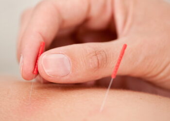 병원 안전 및 CNT 최신판 (4) 침술-기타 내장기관 및 외상성 조직 부상