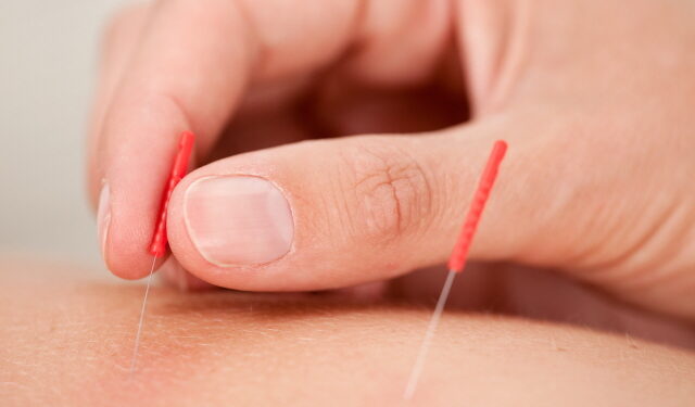 병원 안전 및 CNT 최신판 (4) 침술-기타 내장기관 및 외상성 조직 부상