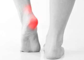 아침 첫걸음에 발뒤꿈치 ‘찌릿’ 통증 느낀다면? 한의 치료 및 예방법!