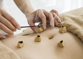 병원 안전 및 CNT 최신판 (5) 쑥뜸의 안전성 및 부작용