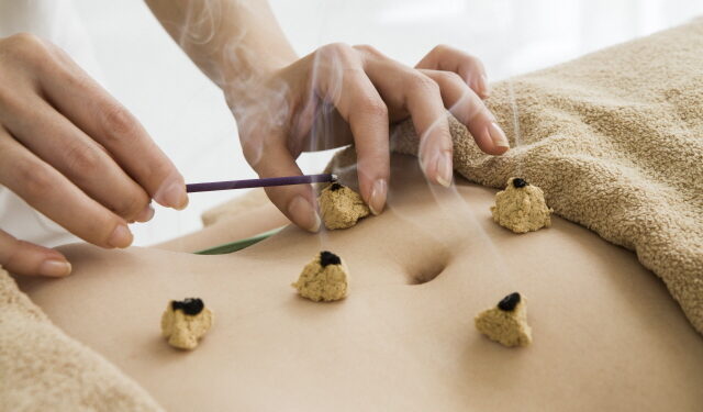 병원 안전 및 CNT 최신판 (5) 쑥뜸의 안전성 및 부작용