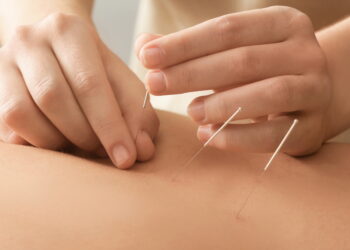미국, 병원 의료시스템 내 한의학·침 치료 통합 확산