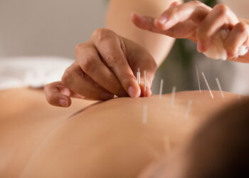 “8주 넘게 장기치료 받는 車사고 경상환자의 87%는 한방 환자”