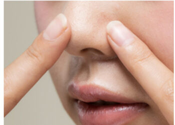 “여름철 늘어나는 피지, 이것만 지켜라”