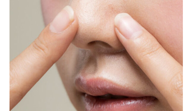 “여름철 늘어나는 피지, 이것만 지켜라”