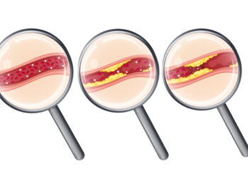 “노화된 혈관, 다시 젊어질 수 있을까?”