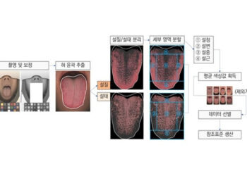 한의학계 최초 ‘설(舌) 색상’ 국가참조표준 개발