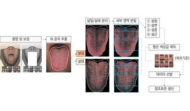한의학계 최초 ‘설(舌) 색상’ 국가참조표준 개발