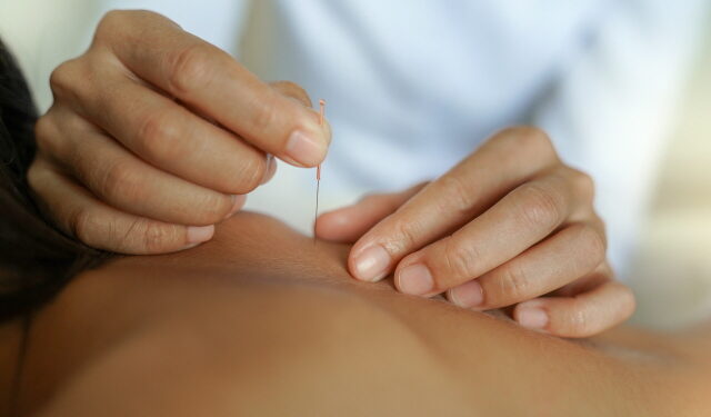 조병식 원장의 최신 동씨침 (29) 각종 인후질환-차삼 효과적∙∙∙후비방 병용 시 탁월