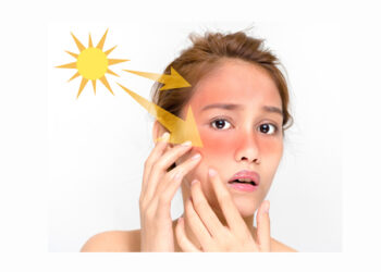 “시도 때도 없이 얼굴이 뜨겁게 달아오른다면?”