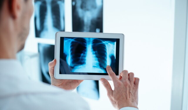 ‘한의사 X레이’ 놓고 의협 “국민 안전 위협” vs 한의협 “진료 선택권 보장”