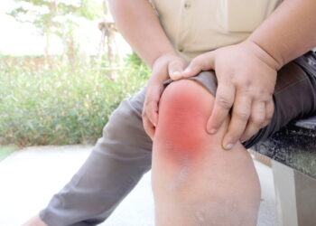 비만, 무릎 관절을 무너뜨리는 ‘주범