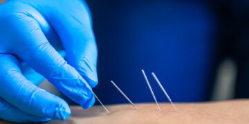 드라이 니들, 40개 주 허용∙불법 주는 단 3곳!