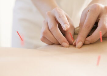 고혈압, 침·한약 병용 투여의 시너지와 기전 밝혀져