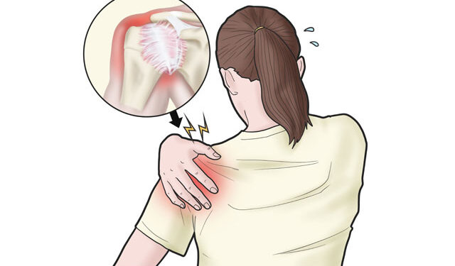 오십견, 관절 굳어지기 전 치료 필수!!!