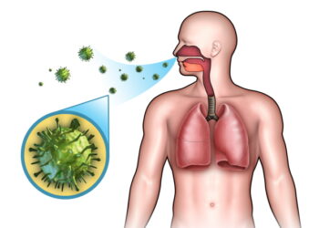 알레르기 비염, 코감기와 주요 차이점은?