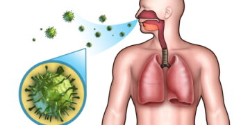 알레르기 비염, 코감기와 주요 차이점은?