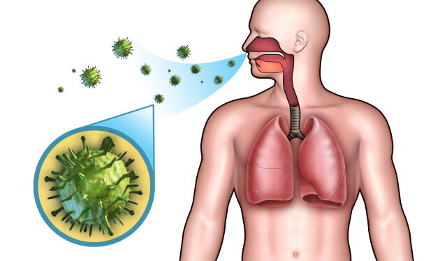 알레르기 비염, 코감기와 주요 차이점은?