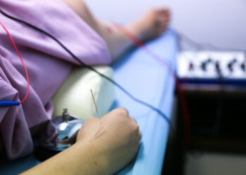 전침(電鍼)의 “불면증 개선 효과” 과학적 규명