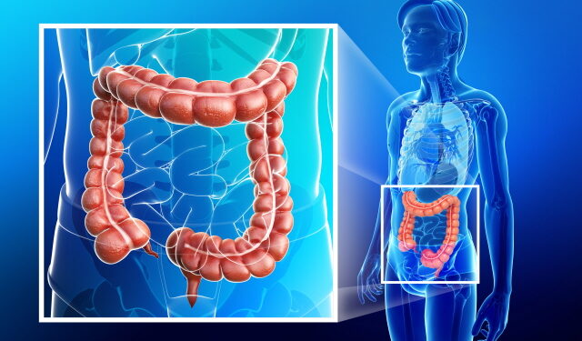 내 ‘장’이 보내는 긴급 신호 ‘궤양성 대장염’ 주의
