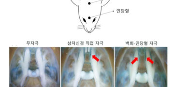 침치료, 외상후스트레스장애(PTSD)의 “우울·불안” 동시 완화!