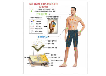 팔에서 전기 만들어 심전도 측정…배터리 없는 심전도 센서 개발