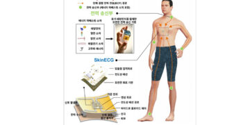 팔에서 전기 만들어 심전도 측정…배터리 없는 심전도 센서 개발