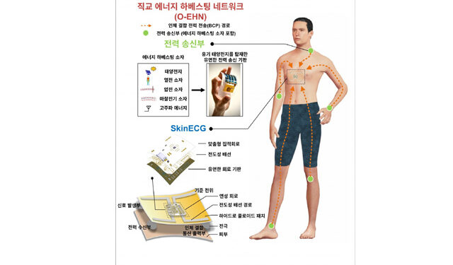 팔에서 전기 만들어 심전도 측정…배터리 없는 심전도 센서 개발