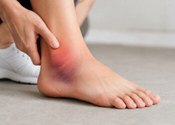 발목 인대 손상 후 자꾸 ‘삐끗’···반복되는 발목 염좌 막으려면?