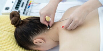 만성 목 통증, 전침 주 3회 치료가 주 1회보다 효과적